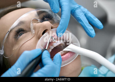 Female patient in lunettes de protection à bretelles et d'un enrouleur joue dans une clinique dentaire. Dentiste dans des gants en latex bleu est le nettoyage de ses dents avec un h Banque D'Images