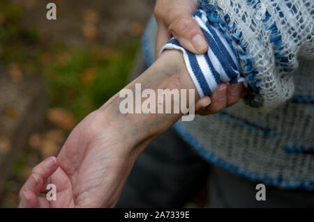 Bleu profond à gauche après l'injection sur une main de femme, close-up Banque D'Images