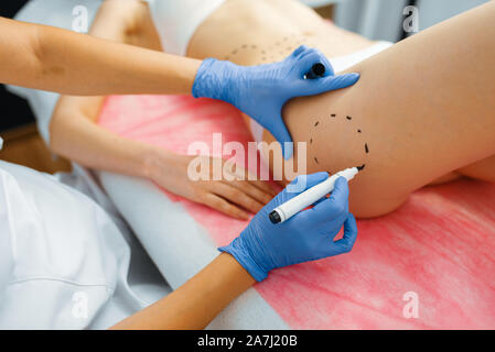 Cosmetician avec le marqueur met les lignes en pointillé sur le corps Banque D'Images