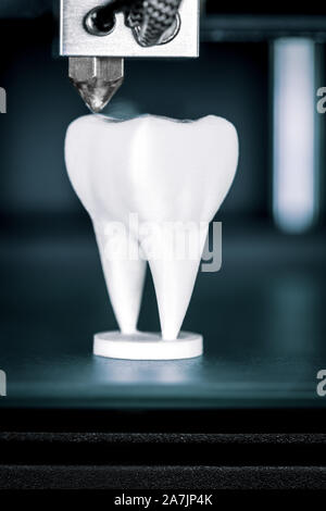 À l'aide d'une imprimante 3D en dentisterie, dentiers sont faites par la fabrication de filaments fusionnés Banque D'Images