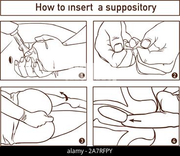 Dessin pour montrer l'emplacement et la technique de l'insertion d'un suppositoire pour la distribution de médicaments par le rectum Illustration de Vecteur