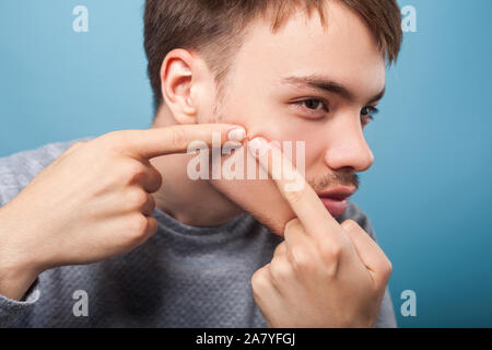 L'hygiène et les problèmes de peau. Portrait de jeune femme brune Homme avec moustache et poils presser bouton sur le visage, l'acné, soins de la souffrance des hommes. je Banque D'Images