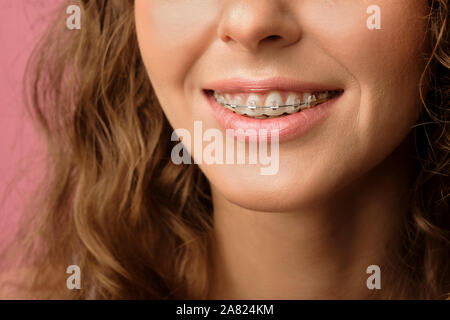 Photo de gros plan joli sourire de femme de race blanche sourire avec les cheveux bouclés portant appareil dentaire isolé sur fond rose. Banque D'Images