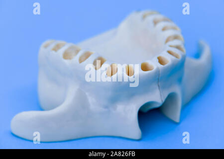 Les dents de la mâchoire supérieure sans modèle medical illustration isolé sur fond bleu. Des dents en bonne santé, les soins dentaires et orthodontiques concept Banque D'Images