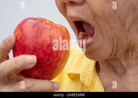 Une vieille femme porte des lunettes et sans dents en essayant de manger des pommes rouges. Concept de problèmes de santé dentaire, les patients âgés et les soins médicaux conc Banque D'Images