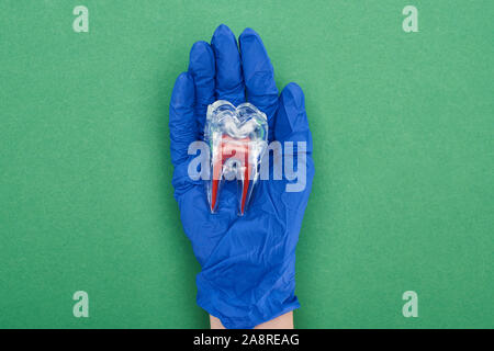 Portrait de dentiste en gants en latex bleu modèle dent holding avec racine dentaire Rouge sur vert Banque D'Images