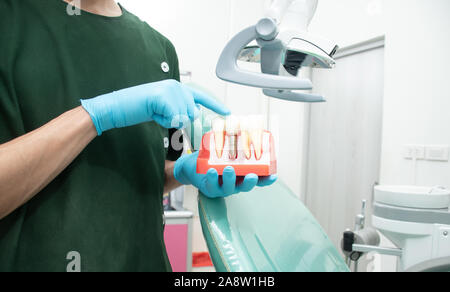 Male dentist en uniforme vert portant un échantillon des implants dentaires par rapport aux dents naturelles d'expliquer en détail. La connaissance est pour les patients avant Banque D'Images