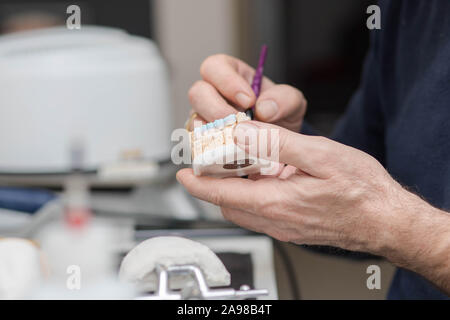 Pierre plâtre dentaire travail modèle de faire un pont et les couronnes en cours en laboratoire dentaire par le technicien dentaire Banque D'Images