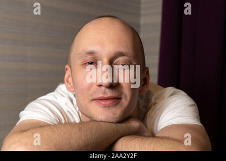 Un homme de 30 ans, avec pas de cheveux mit son menton sur ses mains et le regarde en plissant les yeux à l'appareil photo. Portrait d'un jeune homme en t-shirt blanc. Banque D'Images