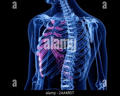Cartilage costal, illustration de l'ordinateur. Banque D'Images