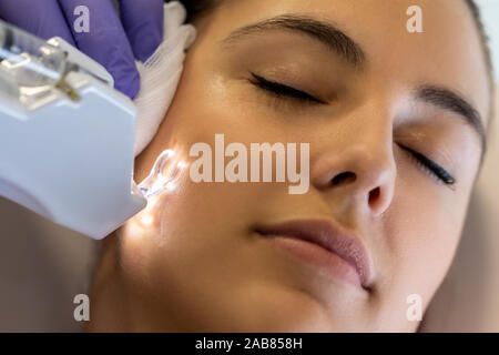 Face Close up shot of young woman ayant retiré la cicatrice sur la joue. Micro micro thérapeute ayant besoin de périphérique sur la joue de la femme. Banque D'Images