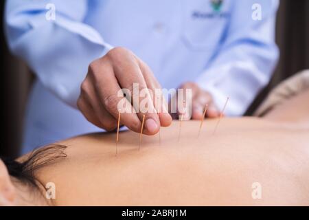 Jeune femme l'objet d'un traitement d'acupuncture sur le dos Banque D'Images