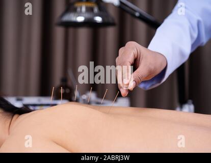 Jeune femme l'objet d'un traitement d'acupuncture sur le dos Banque D'Images