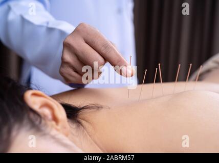 Jeune femme l'objet d'un traitement d'acupuncture sur le dos Banque D'Images