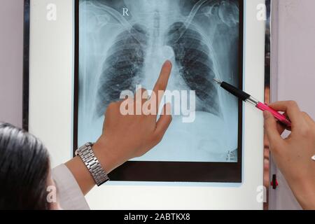 Doctors looking at x-ray. L'hôpital de cardiologie. Ho Chi Minh Ville. Le Vietnam. Banque D'Images