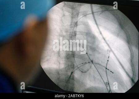 L'hôpital de cardiologie. La radiologie diagnostique. L'angiographie. Ho Chi Minh Ville. Le Vietnam. Banque D'Images