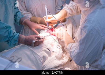 Les médecins - chirurgiens d'enfants, dans une salle d'opération stérile, effectuer une opération des reins. Mains du chirurgien holding surgical instruments, manipuler Banque D'Images