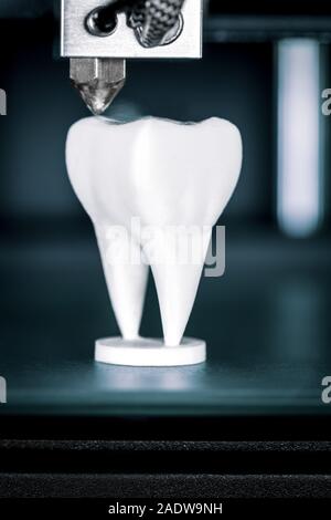 À l'aide d'une imprimante 3D en dentisterie, dentiers sont faites par la fabrication de filaments fusionnés Banque D'Images