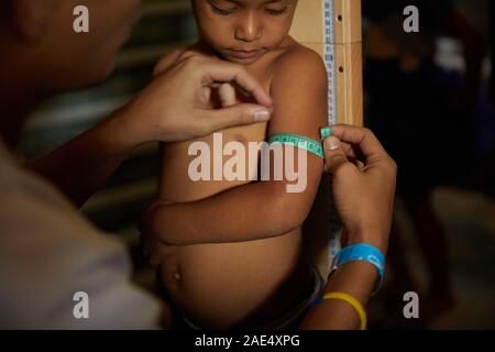 Caracas, Venezuela, Miranda. 29 Nov, 2019. Un enfant a son bras mesuré pour voir si il a des signes de malnutrtion dans le cadre d'un contrôle médical par des bénévoles. Une crise majeure se produit dans le pays d'Amérique du Sud du Venezuela. Un gouvernement corrompu et massive de l'inflation a causé un grand manque dans les soins de santé. Dans ces bidonvilles pauvres souffrent beaucoup. Certaines ONG tentent d'aider autant qu'ils le peuvent. L'une de ces ONG est Impronta Venezuela. Impronta est un organisme à but non lucratif qui est née avec le but de transformer la réalité qui nous interpelle, d'offrir des possibilités fo Banque D'Images