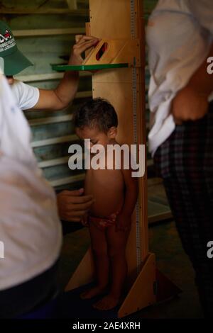 Caracas, Venezuela, Miranda. 29 Nov, 2019. Un enfant a sa hauteur prises dans le cadre d'un contrôle médical par des bénévoles. Une crise majeure se produit dans le pays d'Amérique du Sud du Venezuela. Un gouvernement corrompu et massive de l'inflation a causé un grand manque dans les soins de santé. Dans ces bidonvilles pauvres souffrent beaucoup. Certaines ONG tentent d'aider autant qu'ils le peuvent. L'une de ces ONG est Impronta Venezuela. Impronta est un organisme à but non lucratif qui est née avec le but de transformer la réalité qui nous interpelle, d'offrir des possibilités pour les populations les plus vulnérables à la r Banque D'Images