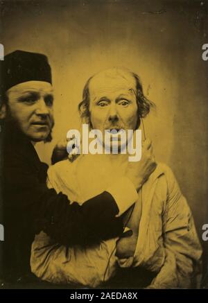 Guillaume-Benjamin Duchenne-Amant (de Boulogne), Surprise, surprise 1854-1855 ; entre 1854 et 1855 date Banque D'Images