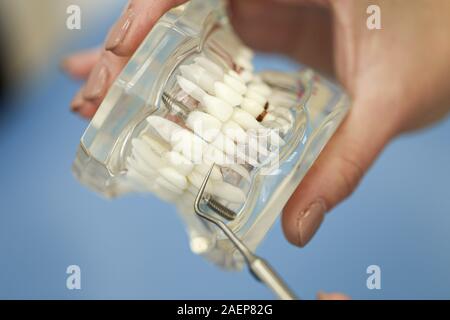 Photo gros plan de la femme médecin avec modèle de mâchoire dans les mains. Banque D'Images