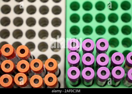 Tubes à essai dans un laboratoire médical, vue du dessus. Concept de la recherche, des soins de santé, don de sang, Banque D'Images