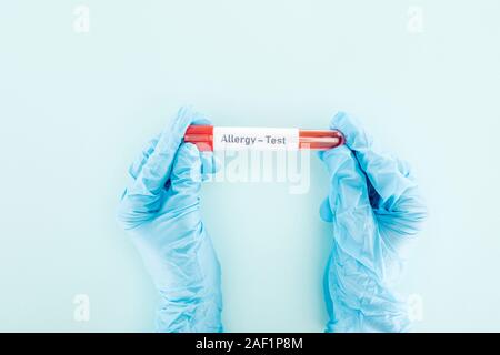 Portrait du docteur gants en latex holding test tube avec l'échantillon d'un test d'allergie et le lettrage sur blue Banque D'Images