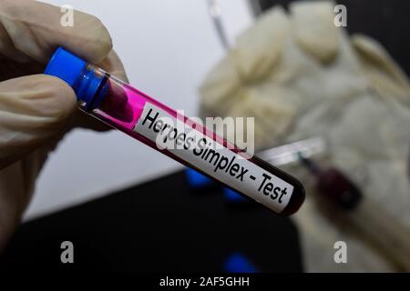 - Test de l'Herpès simplex avec échantillon de sang. Vue de dessus de bureau isolé sur 24. Concept de soins santé/médecine Banque D'Images