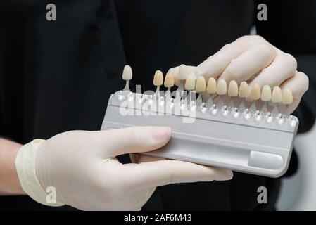 Le médecin tient dans sa main des tests pour les dents du patient avant le blanchiment Banque D'Images