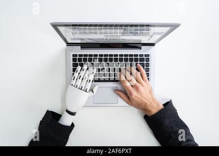 Homme avec prothèse de main travaillant sur ordinateur portable. Membre artificiel Banque D'Images