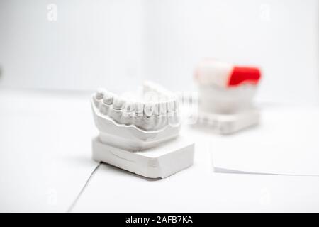 Modèles de gypse de mâchoire artificielle avec caps dentaires sur le fond blanc. Les capuchons et bouchons de boxe d'orthodontie Banque D'Images