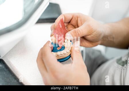 Technicien dentaire travaillant sur le gypse jaw, placer une couronne sur implant dans la mâchoire artificielle au laboratoire, close-up view Banque D'Images