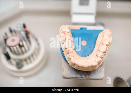 Mâchoire artificielle pour la modélisation des implants avec jeu de fraises dentaires sur le lieu de travail de technicien en laboratoire dentaire Banque D'Images