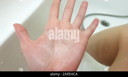 Main de femme froissé à cause de tremper dans l'eau pendant une longue période, et salle de bains blanc humide de la jambe sur l'arrière-plan. Banque D'Images