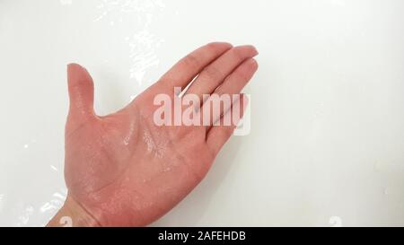 Main de femme froissé à cause de tremper dans l'eau pendant une longue période, d'un salle de bains blanc sur l'arrière-plan. Banque D'Images