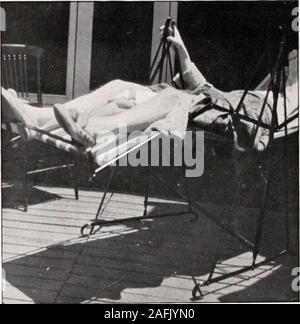 . Transactions de l'Association clinique et climatologiques américains.. sur de l'énergie thesolar sur le corps humain peut être utile. Les rayons du soleil tombant sur la peau de l'un de produire une première course thewhite congestion, suivie d'une irrita-tion ou de brûler si continué assez longtemps. Cette première conges-tion, s'il n'est pas poussé au point d'irritation ou destructionof la couche externe de la peau, est bénéfique pour le corps. inseveral Les navires sont dilaté, internalcongestion est relevée, l'andlymph la circulation du sang est stimulée, le coeur et l'enfant avec l'aide d'action-ney Banque D'Images