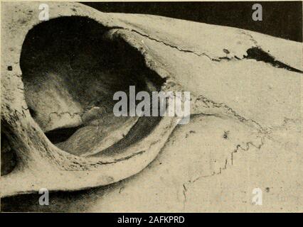 . Annales des sciences naturelles. Fig. - 19. Région lacrymale Girafe Ç du Sénéf de dunes,vil, dépouivue de lacuneprélacrymale. Remarquer notamment los wormien de la partie antérieure et la dulacrymal lorme de la bulle lacrymale. La ligne de suture du maxillaire et dufrontal (voy. texte ci-contre) sétend en avant de los wormien. (Collections dAna-tomie comparée du Muséum de Paris : n" A. 10,753.) Env. 3/4 gr. nat.. Région lacrymale du Boeuf (Collections dAnatomie comparée du Muséum:A" 1885-231, Boeuf des Stiengs, du Cambodge). Env. 3/4 gr. nat. 62 MAURICE DE ROTHSCHILD ET HENRI NEUVILLE en dilï-ér Banque D'Images