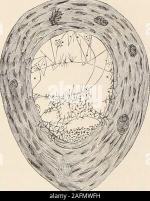 . Archives de médecine : Un bi-mensuel consacré aux communications d'origine sur la médecine, la chirurgie, et leurs branches spéciales.. doit, au moins, d'agir comme un filtre pour le fluide qui les traversent, conservant le plus d'éléments solides, et éventuellement theymust produire un arrêt dans les vaisseaux ainsi touchés. Je ne me sens pas prêt à rejoindre le professeur Klebs dans theseorganisms schizomycetae avec la classification, comme dans un certain nombre d'thespecimens ils semblent avoir le myxomycetae characteristicof la structure. Les filaments ramifiés, penetratingpartly les parois des vaisseaux et formant une amende networkin e Banque D'Images