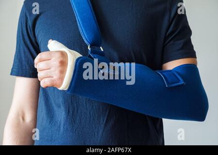 Homme avec plâtre sur le pouce cassé, fracture du poignet, fracture de la main sur le bras sling Banque D'Images