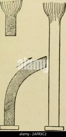 . Manuel de chirurgie opératoire. Fig. 1529. Fig. 1530. Fig. 1531. Tensions est sécurisé pour permettre de transfert ou l'application du point de l'powerto musculaire d'insertion tendineuse. Un tendon lax entre le muscle et l'ofinsertion point est inutile. Dans la Fig. 1526 les tendons à la fois du donneur et du receveur sont com-plètement divisé et la partie périphérique du donateur est jeté, c.-à-d., aucune. Banque D'Images