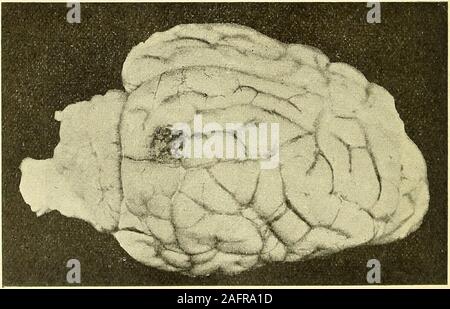 . Physiologische und klinische Untersuchungen über das Gehirn, gesammelte Abhandlungen. Fig. 171. 3&lt;J9 - T;J, Bell 0 Via. Läsionen Laterale. Atyp. isclif derOperation Art m Ort der (Seetion) 10102 Exstirpa- tion ca. s/, cm tief. Ca Exstirpa- tion. 7 mm Tief. 03- Exstirpa ca. ^ ^/ cm. tief. 04 Liens. IL Urwindungund Theilder Ferienwohnungen hillbrand nach-biegender Tlieil um latérale derI. Urwindung. Gcsce-tal 14 mm, frontal6 mm. Annäherndparallel der Mittel-Linie. 156. AbsteigenderTheil der I. und hin-terer Theil der ILUrwindung. Mm11 sagittale frontale, 6 mm.Annähernd Mittellinie paralleder Banque D'Images