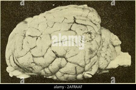 . Physiologische und klinische Untersuchungen über das Gehirn, gesammelte Abhandlungen. Banque D'Images