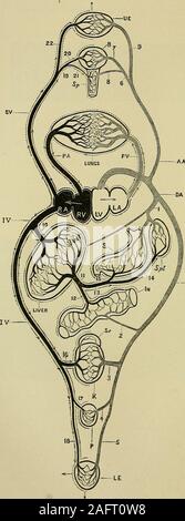 . Les maladies du coeur et l'aorte thoracique. Fig. 57.-Représentation de l'eftects d'une lésion de la valve mitrale (mitralstenosis dans ce cas) sur le coeur et la circulation. Les effets de l'mitralregurgitation sont les mêmes, mais il y a, en outre, de l'hypertrophie du ventricule gauche. LV  = ventricule gauche ; LA  = oreillette gauche ; PV =pulmonaryveins Iungs ; L = ; PA =artère pulmonaire ; RV =ventricule droit ; RA =oreillette droite ; V =ven£e ; V  = cavse^ système veineux ; £  = fin du système veineux dans les capillaires systémiques ; A =l'aorte ; Ai  = thearterial système. Les flèches indiquent la direction de l'arrière Banque D'Images