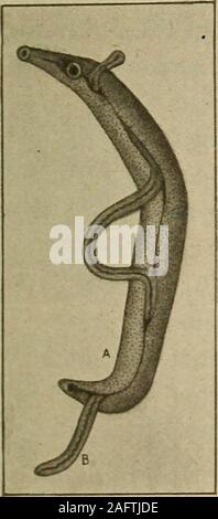 . Diagnostic médical pour l'étudiant et le praticien. Fig. 550 -B alan ti diumcoli. {AfterMalmslen andLeuckhardt.). Banque D'Images