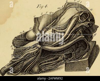 . L'anatomie et de chirurgie de hernie abdominale. Il inndalrs français, del. EXPLICATION DE LA PLAQUE Xle XIX. 413 q. Tronc commun des artères obturatrice et épigastrique. r. L'artère obturatrice passant devant et sur le côté intérieur du col de la sac, dans son cours à l'obturateur fora-hommes, et situé un peu au-dessus du bord postérieur du muscle oblique externe. s. L'artère épigastrique. Une gravure de cette préparation a été publiée dans une thèse sur-génie dans l'hernie, Crural par le Dr James Sanders, Edin-Burgh, 1805. Assiette XX. Montre 3 herniae ombilical, dont un qui est curieux sur un Banque D'Images