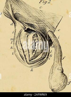 . L'anatomie et de chirurgie de hernie abdominale.  ?X 7*FreneA,, t£eZ XtOt StftcZcLLTS- EXPLICATION DE LA PLAQUE XVL 405 Fig = 3. Vue postérieure de la figure 1. a. Symphyse pubienne. b. Apophyse épineuse de l'ilium. c. Ilium. d d d. Le Rectus et d'autres muscles abdominaux, e. Linea semilunaris. /. Bord postérieur du passage crural. g. Fascia iliaca. h. Le muscle iliacus. i i. Le fascia transversalis. k. Anneau abdominal interne. Z. cordon spermatique passant par l'anneau interne. m. Artère iliaque externe. n. Veine iliaque externe, o. Veine et artère épigastrique. p. Sac de hernie crural Banque D'Images