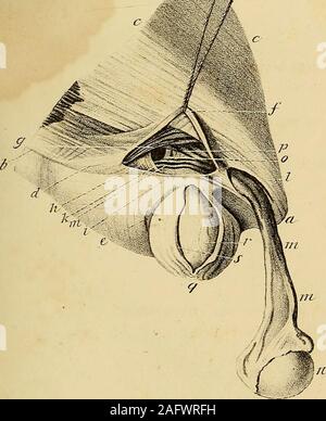 . L'anatomie et de chirurgie de hernie abdominale. Ft ?. 7.. Banque D'Images