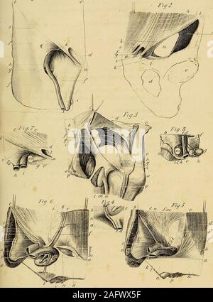 . L'anatomie et de chirurgie de hernie abdominale. liaca. k. Gaine fémorale. 7. Artère fémorale. m. Veine fémorale. n. Saphsena veine majeure. o. Nerf crural antérieur. p. Fascia lata refoulés. q. Tendon du muscle oblique externe, tirée vers le bas. Fig. 4. Vue arrière de l'endroit où l'hernie crural descend,tel qu'il apparaît lorsque le péritoine est d'abord retiré. a. Pubis. b. Les abdominaux. c. Ligament rond passant dans l'intérieur de l'anneau de l'abdomen. d. Artère fémorale. e. Veine fémorale. /. L'artère épigastrique. g. Veine épigastrique. h. La dépression à laquelle la hernie crural première desce Banque D'Images