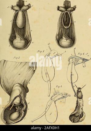 . L'anatomie et de chirurgie de hernie abdominale. Le côté placé vers le sac ; itsedge est d'être tourné vers l'avant pour diviser l'anneau. Fig. 6. Hernie sur le côté intérieur de l'artère épigastrique. a. L'anneau de l'abdomen. b. Ligament Pouparts. c. Artère fémorale. d. L'artère épigastrique. e. Les muscles transverse et oblique interne passant sur le sac. /. Tendon du muscle transverse passant sous elle. g. Fascia de Pouparts ligament, d'où le cordon est retiré pour montrer l'endroit par lequel il passe. h. Sac herniaire. i. Sac herniaire au-dessus de l'anneau. k. Le couteau a présenté pour montrer le mann Banque D'Images